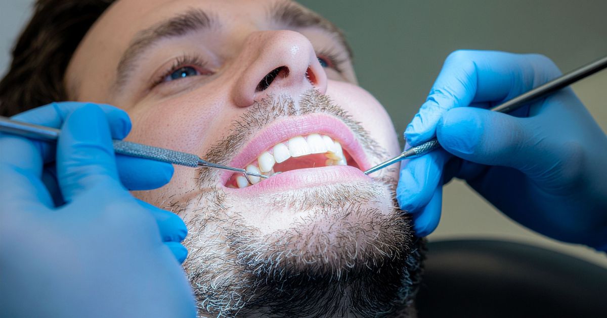 Close-up of a chipped front tooth being assessed by a dentist